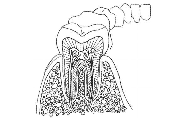 Anatomy of Teeth